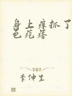 身上痒抓了起红色疙瘩