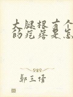 大腿根有个红色的疙瘩是怎么回事封面