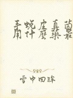 手蜕皮真菌感染用什么药最好