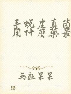 手蜕皮真菌感染用什么药最好