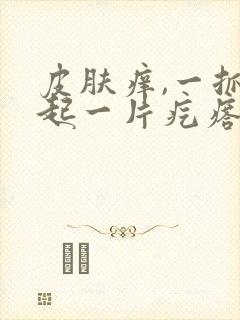 皮肤痒,一抓就起一片疙瘩是什么毛病