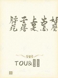 脖子上出好多小疙瘩是怎么回事