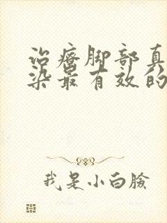 治疗脚部真菌感染最有效的药