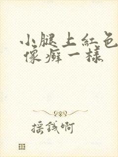 小腿上红色圆圈 像癣一样