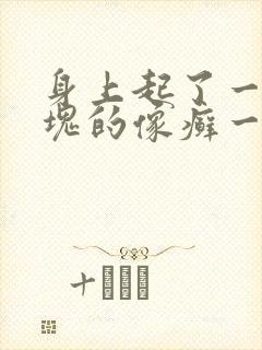 身上起了一块一块的像癣一样红色不疼不痒