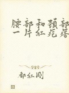 腰部和颈部长了一片红疙瘩痒封面