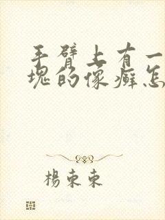 手臂上有一块一块的像癣怎么办