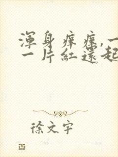 浑身痒痒,一挠一片红还起疙瘩