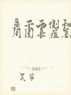 鼻子两侧和嘴巴周围长痘怎么办