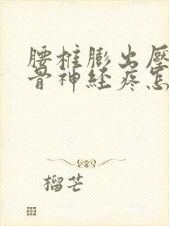 腰椎膨出压迫坐骨神经疼怎么办