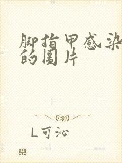 脚指甲感染真菌的图片