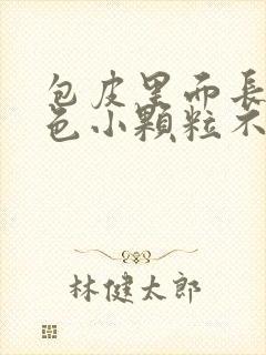 包皮里面长了白色小颗粒不痛不痒