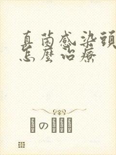 真菌感染头皮屑怎么治疗