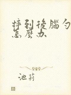 摔到后脑勺头晕怎么办