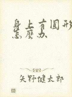 身上有圆形的癣怎么办