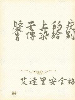 脖子上的疣会不会传染给别人