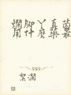 烂脚丫真菌感染用什么药最好