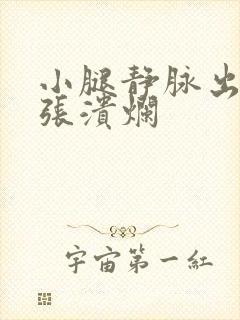 小腿静脉出现曲张溃烂