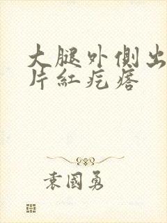 大腿外侧出了一片红疙瘩封面