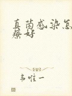 真菌感染怎样治疗好