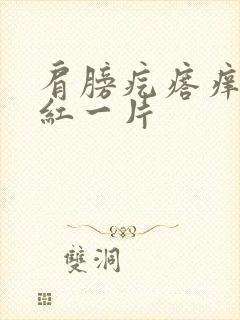 肩膀疙瘩痒抓了红一片