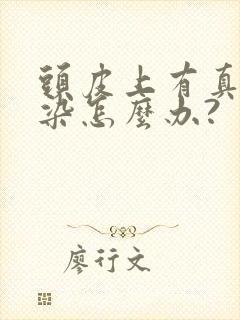 头皮上有真菌感染怎么办?