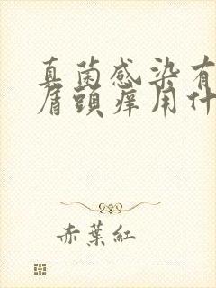 真菌感染有头皮屑头痒用什么方法好封面