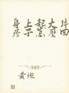 身上起大片的红疹子怎么回事