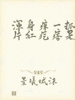 浑身痒一抓就一片红疙瘩是怎么回事