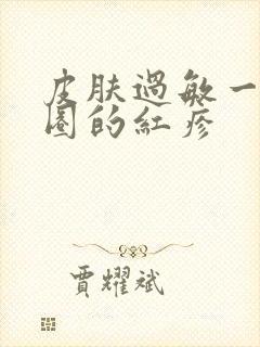 皮肤过敏一圈一圈的红疹