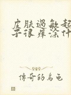 皮肤过敏起红疹子很痒涂什么药