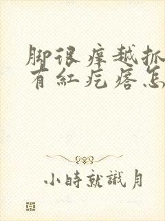 脚很痒越抓越痒有红疙瘩怎么办