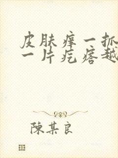 皮肤痒一抓就起一片疙瘩越挠越痒封面