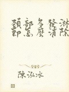 颈部多发淋巴结节怎么消除