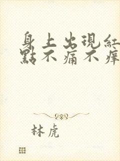 身上出现红色斑点不痛不痒