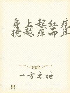 身上起红疙瘩越挠越痒而且一片一片封面