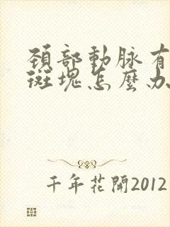 颈部动脉有混合斑块怎么办封面