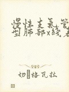 慢性支气管炎典型肺部x线表现是