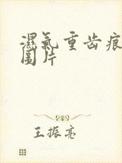 湿气重齿痕舌头图片