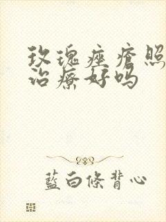 玫瑰痤疮照黄光治疗好吗