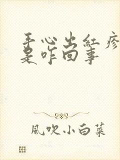 手心出红疹子痒是咋回事封面