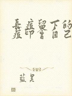 长痘留下的黑色痘印会自己消除吗