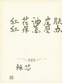 红花油皮肤过敏红痒怎么办