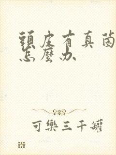 头皮有真菌感染怎么办