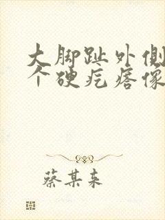 大脚趾外侧长了个硬疙瘩像茧