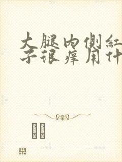 大腿内侧红色疹子很痒用什么药膏