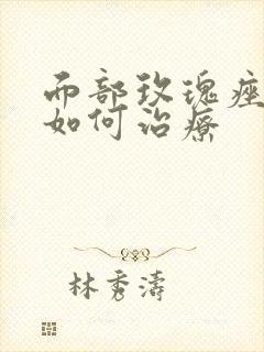 面部玫瑰痤疮该如何治疗