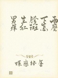 男生胯下两侧瘙痒红斑怎么办