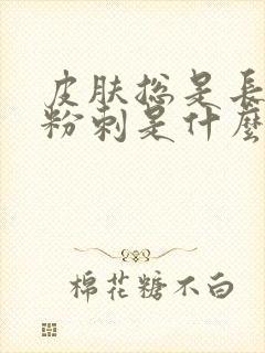 皮肤总是长闭口粉刺是什么原因