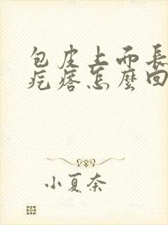 包皮上面长了小疙瘩怎么回事